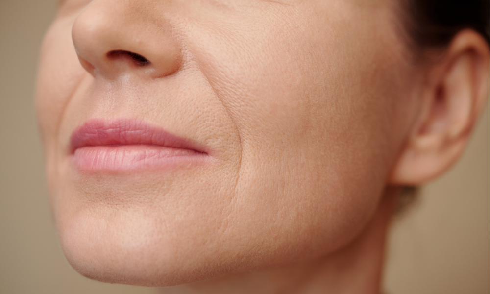 The Best Natural Moisturisers for Dry Skin